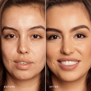  A side-by-side comparison shows a woman's face before and after using Jouer Cosmetics' Essential Crème Foundation. The "before" image displays more noticeable acne and less even skin tone. The "after" image showcases clearer skin, even complexion, and enhanced features with this cruelty-free makeup.